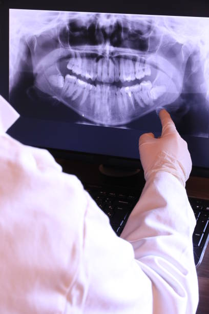 Best Emergency Gum Treatment in Foresthill, CA