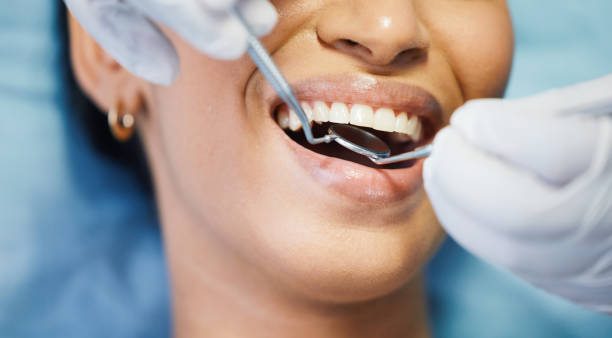 Best Emergency Tooth Extraction in Foresthill, CA